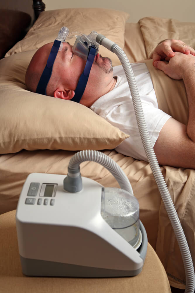 Treatments for Sleep Apnea: Mechanical